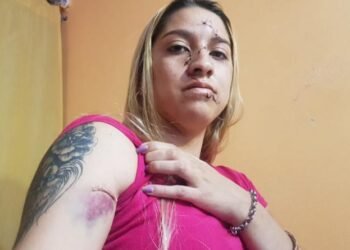 Brutal agresión a una joven tras una fiesta: la atacaron a botellazos y le hicieron más de 15 puntos