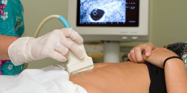 Aunque su pareja no quería, ella decidió practicarse un aborto