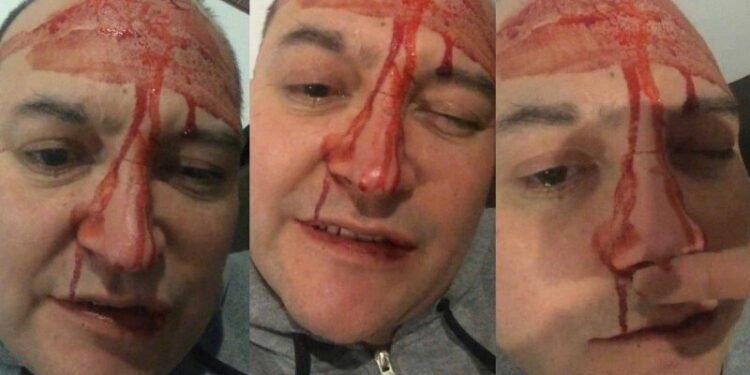 Salvaje ataque a Leo García: ‘Me pasó por ser gay’