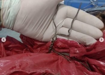 Proteccionistas encontraron a una perrita muerta con un alambre atado al cuello y denunciaron a una empresa constructora