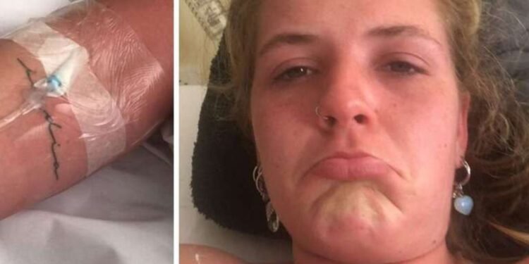 Una mujer fue a la cama solar y terminó con el 90% del cuerpo quemado: “Es insoportable el dolor, me quemé hasta los párpados”