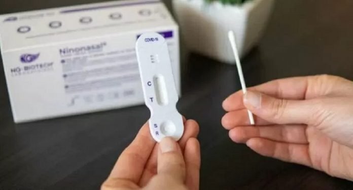 En algunas ciudades ya venden el «AutoTest de Covid»: estiman que en esta semana llegarán al resto del país