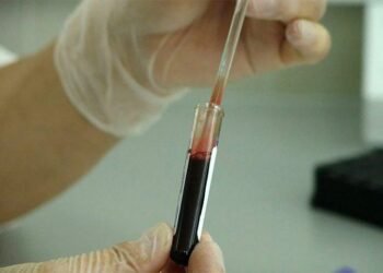 Descubrieron una variante del VIH más virulenta y contagiosa